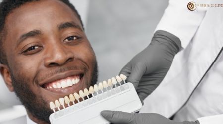 Os Segredos da Odontologia Estética