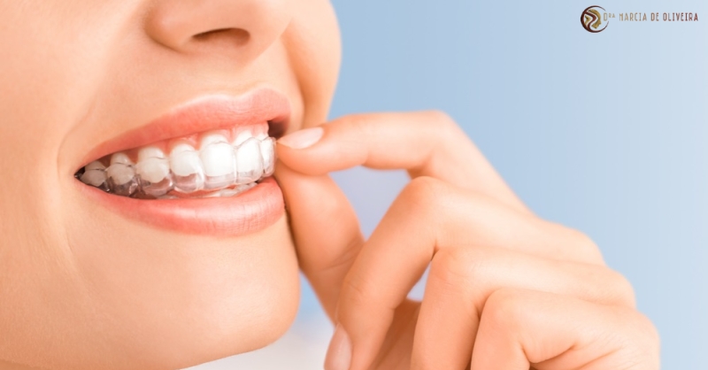 Alinhadores Transparentes: A Evolução da Ortodontia para um Sorriso Discreto