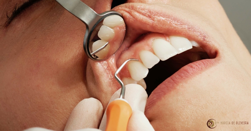 A Importância da Limpeza Dentária Periódica