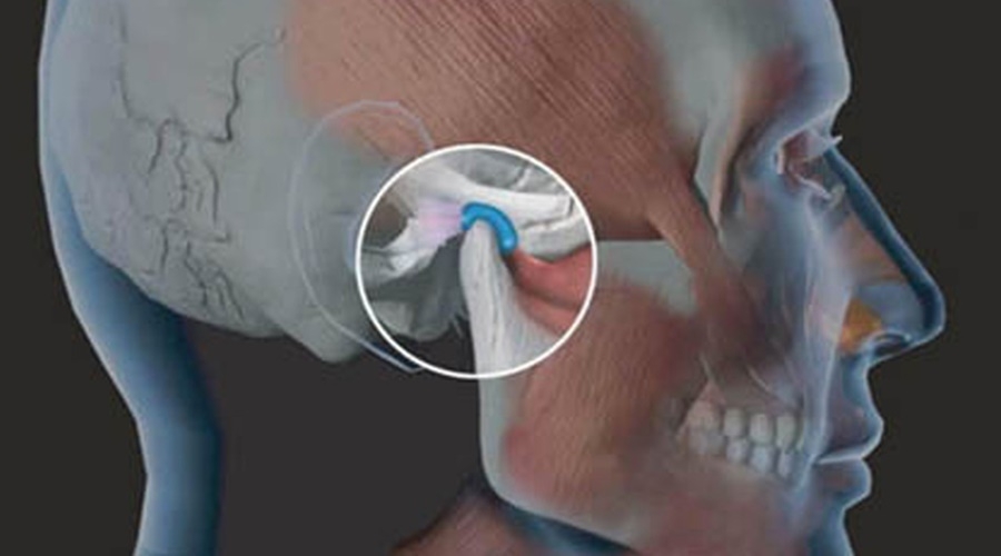 Dor na articulação da mandíbula: o que fazer? - Odonto Scan