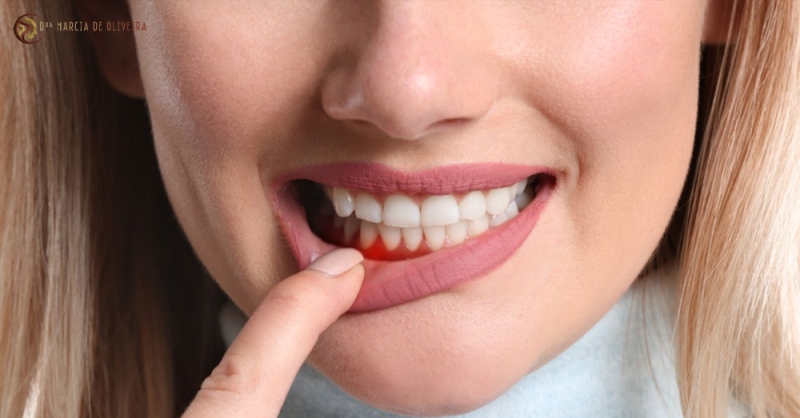Dentes Sensíveis ao Fio Dental?