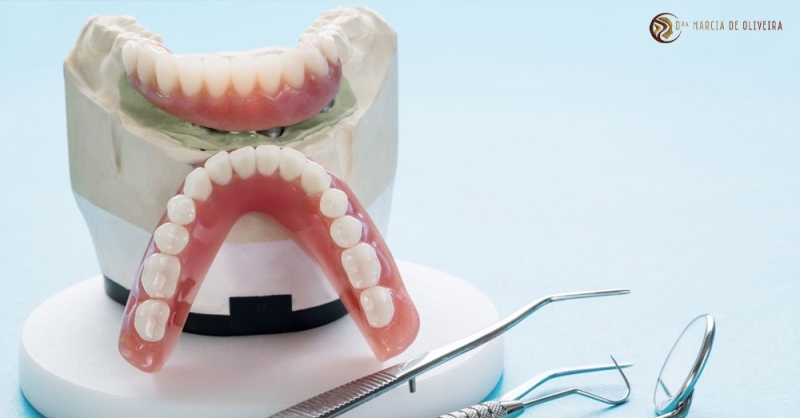 O que é uma prótese dentária móvel?