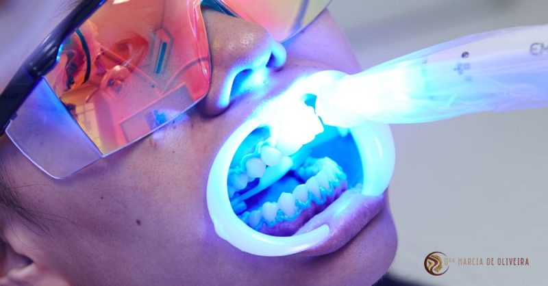 Qual o tipo de clareamento dental mais adequado para você?