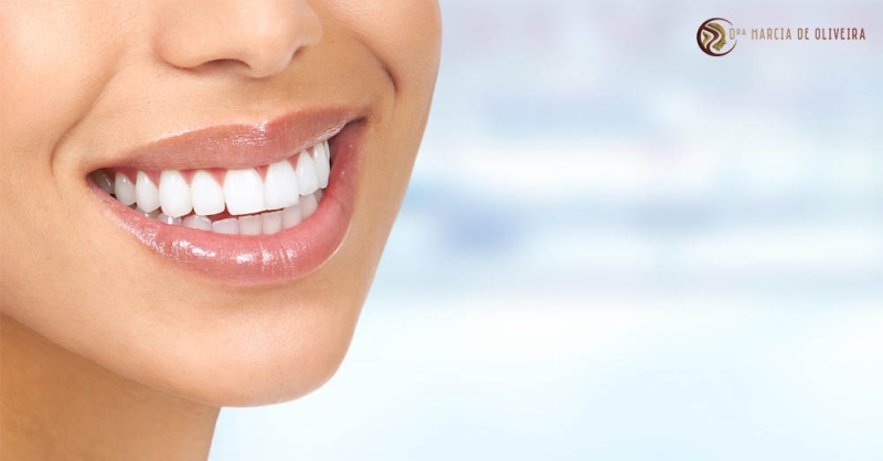 Quando começar um tratamento estético dentário?